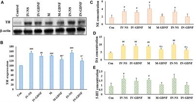 Ultrasound combined with glial cell line-derived neurotrophic factor-loaded microbubbles for the targeted treatment of drug addiction